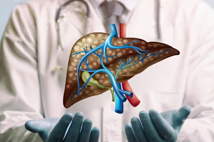 Liver Management